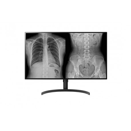 Monitor LG 32HL512D diagnostični